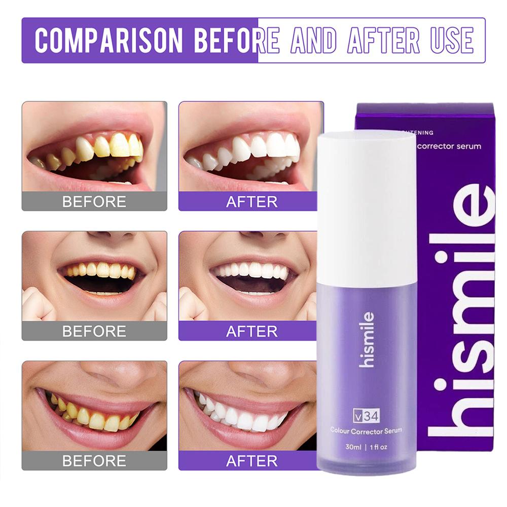 Teeth Paint Whitening - Hismile Purple Toothpaste Teeth Whitening Clean