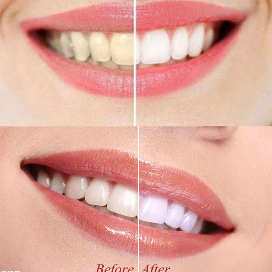 Bamboo Charcoal Teeth Tooth De - Teeth Whitening Instant recension och pris