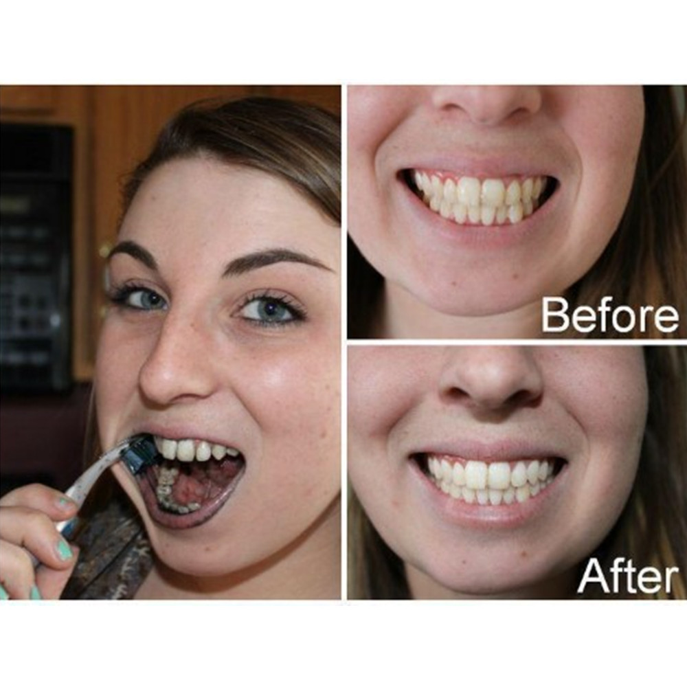 Bamboo Charcoal Teeth Tooth De - Teeth Whitening Instant recension och pris
