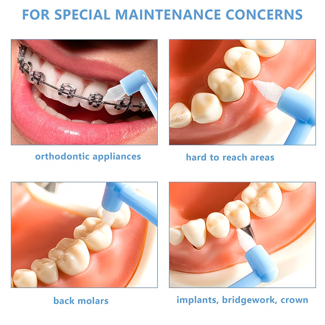 1/3pc Orthodontic Braces Tooth - Teeth Whitening For Braces recension och pris
