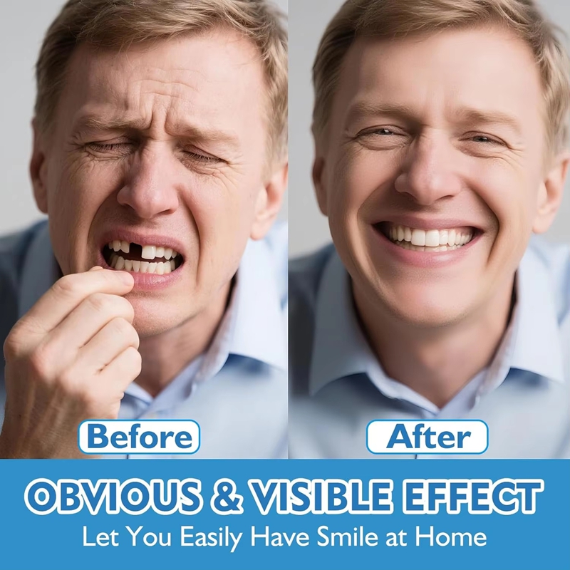 Full Set Silicone Dentures Upp - Teeth Whitening Instant recension och pris