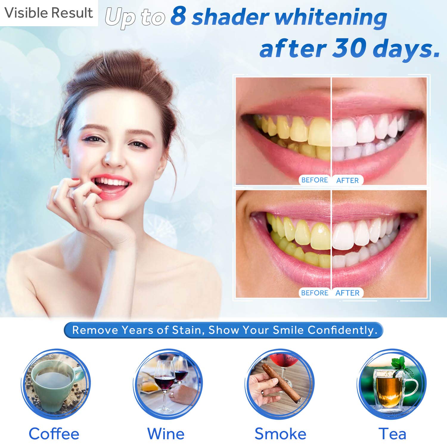 Teeth Whitening Gel Refill Syr - Teeth Whitening Q&M recension och pris