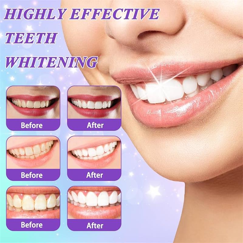 9D Purple Teeth Whitening Toot - Teeth Whitening That Works recension och pris