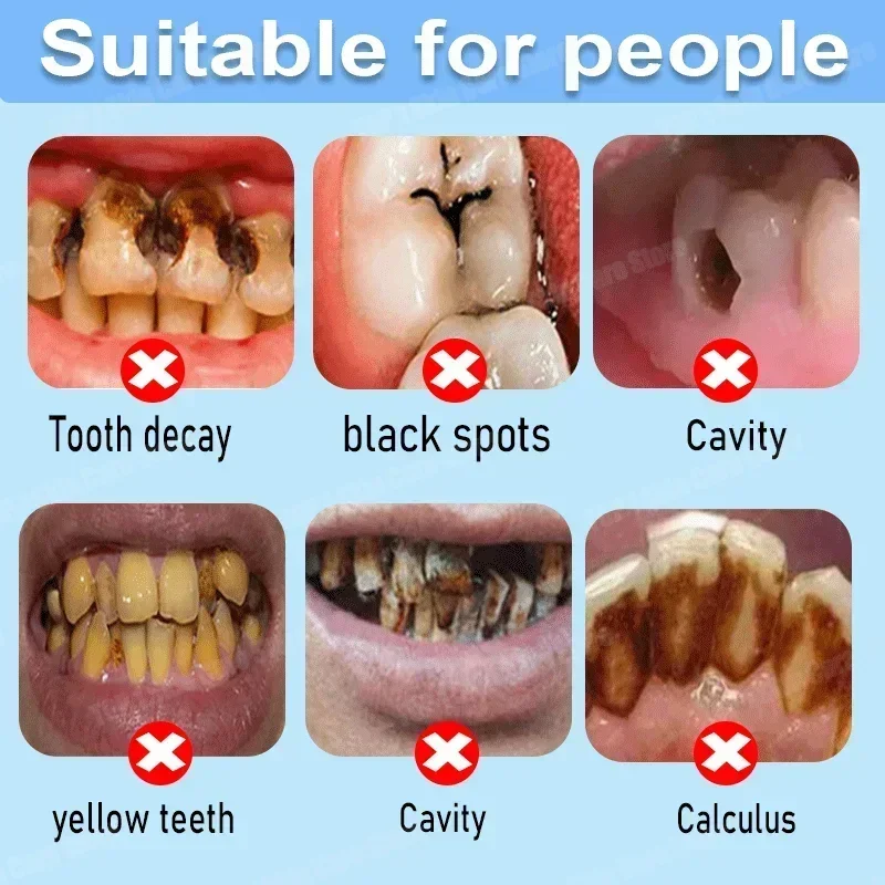 Anti Decay Toothpaste Repairs  - Teeth Whitening That Works recension och pris