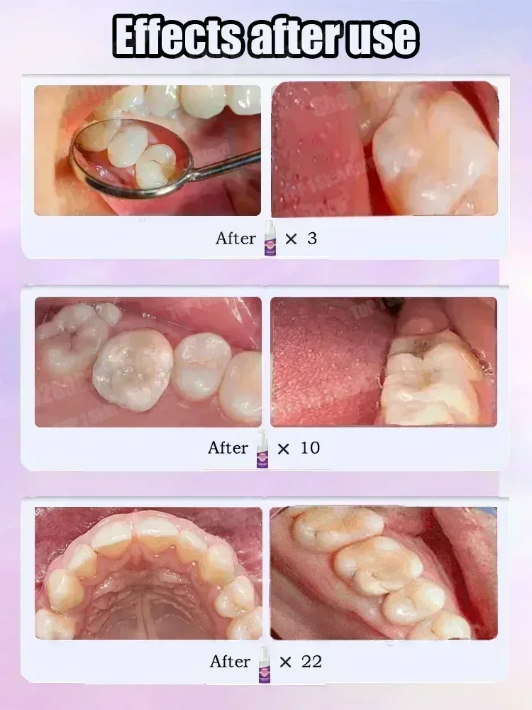 Hot sales Best-selling, Scient - Teeth Whitening That Works recension och pris