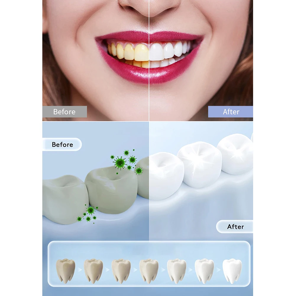 1PC Household Smart LED Teeth  - Teeth Whitening In Office recension och pris