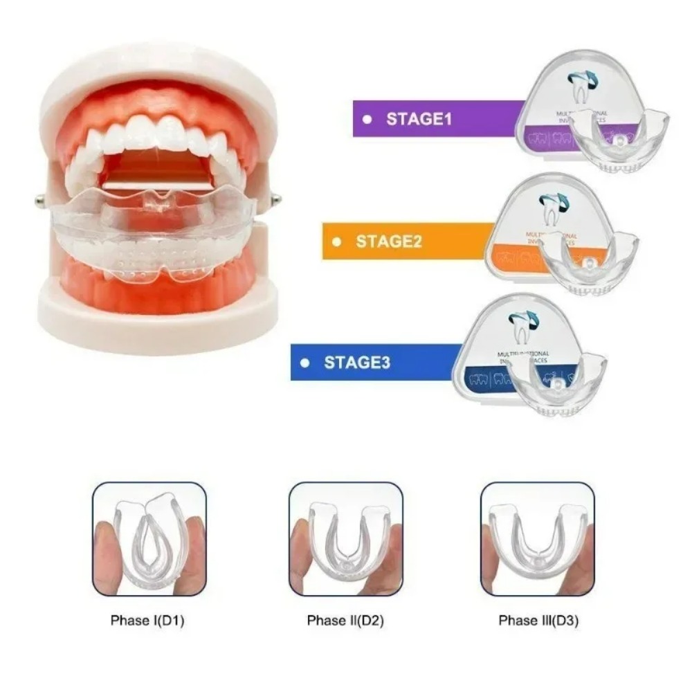Orthodontic Brace Straightener - Teeth Whitening For Braces recension och pris