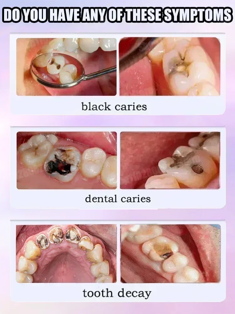 Teeth Cleaning Toothpaste Remo - Teeth Whitening That Works recension och pris