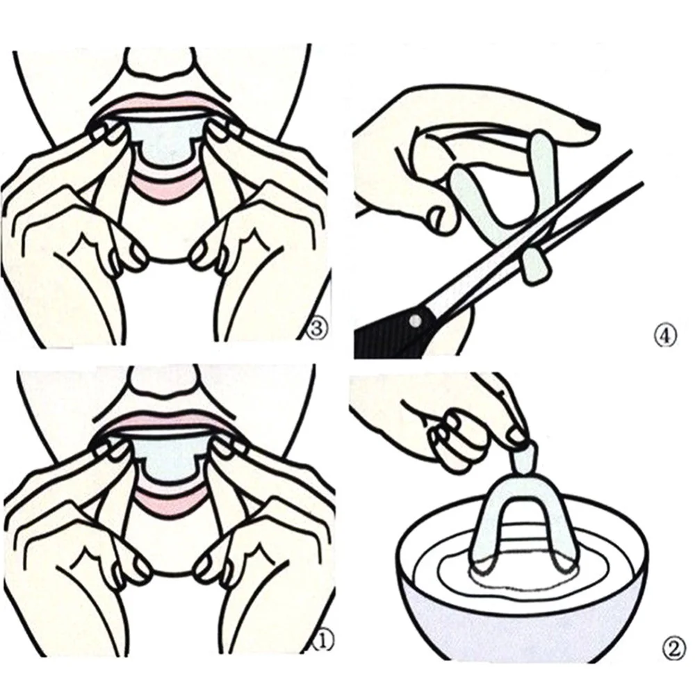 Silicone Braces Cold Light Whi - Teeth Whitening In Office recension och pris